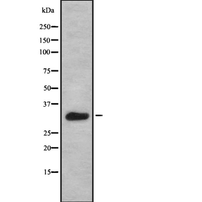 DAPP1 Antibody in Western Blot (WB)