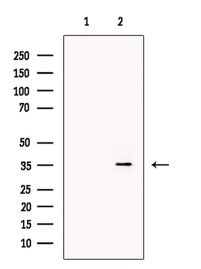 DARC Antibody in Western Blot (WB)