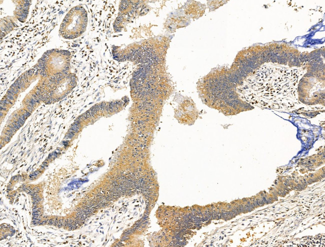 DBT Antibody in Immunohistochemistry (Paraffin) (IHC (P))