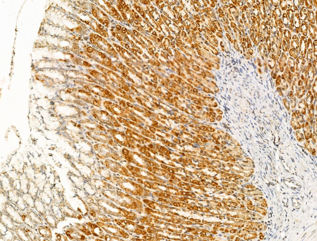 DBT Antibody in Immunohistochemistry (Paraffin) (IHC (P))