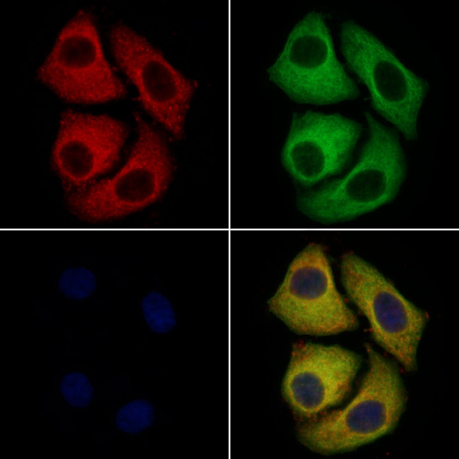 DCC Antibody in Immunocytochemistry (ICC/IF)