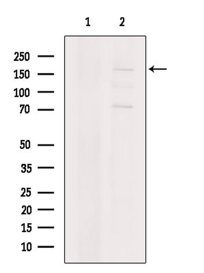 DCC Antibody in Western Blot (WB)