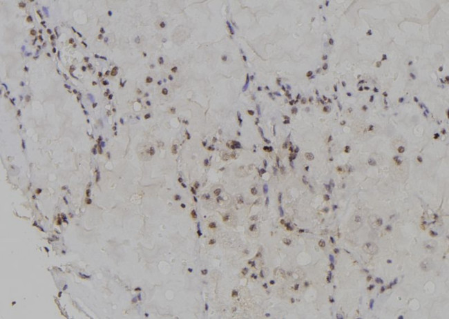 DCK Antibody in Immunohistochemistry (Paraffin) (IHC (P))