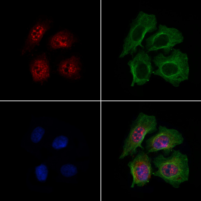 DCP2 Antibody in Immunocytochemistry (ICC/IF)