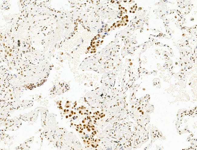 DCP2 Antibody in Immunohistochemistry (Paraffin) (IHC (P))