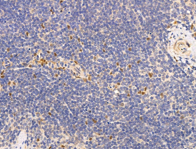 DCP2 Antibody in Immunohistochemistry (Paraffin) (IHC (P))