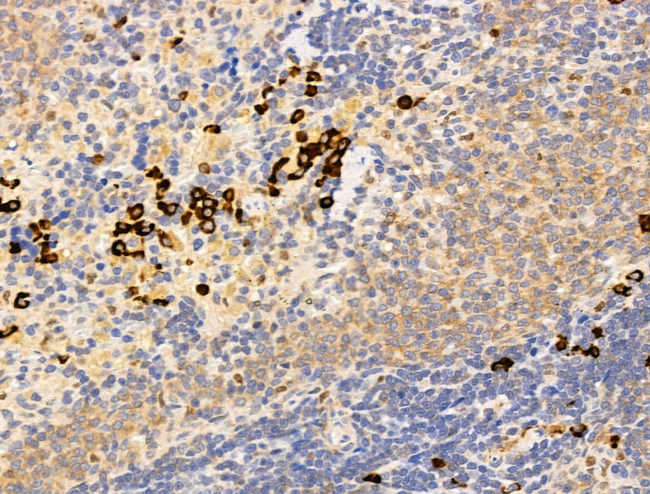 DCP2 Antibody in Immunohistochemistry (Paraffin) (IHC (P))