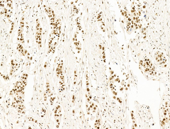 DCP2 Antibody in Immunohistochemistry (Paraffin) (IHC (P))