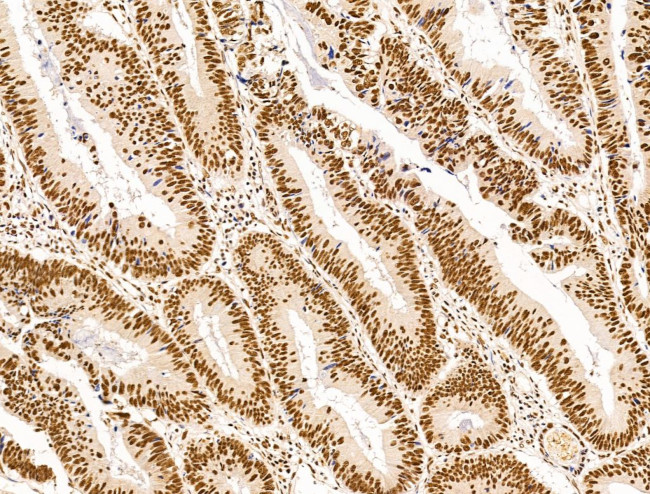 DCP2 Antibody in Immunohistochemistry (Paraffin) (IHC (P))