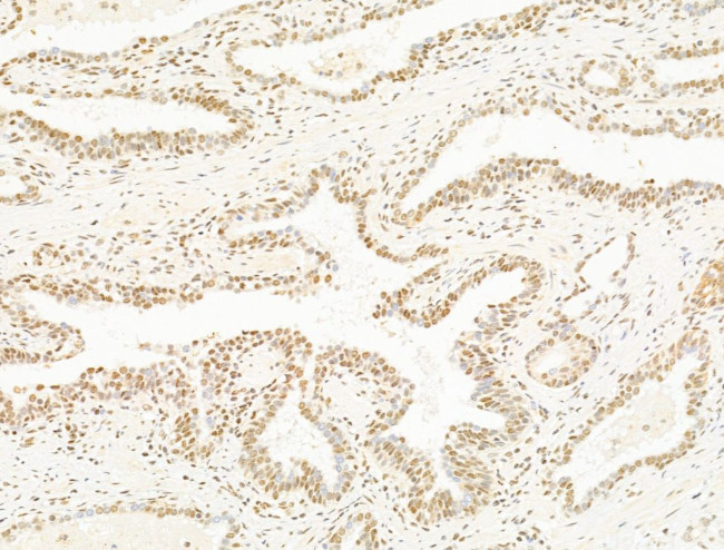 DCP2 Antibody in Immunohistochemistry (Paraffin) (IHC (P))