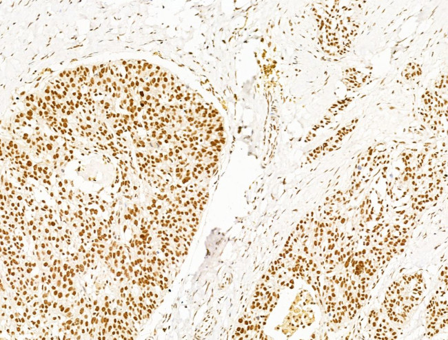 DCP2 Antibody in Immunohistochemistry (Paraffin) (IHC (P))