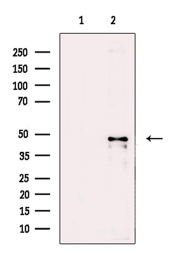 DCP2 Antibody in Western Blot (WB)