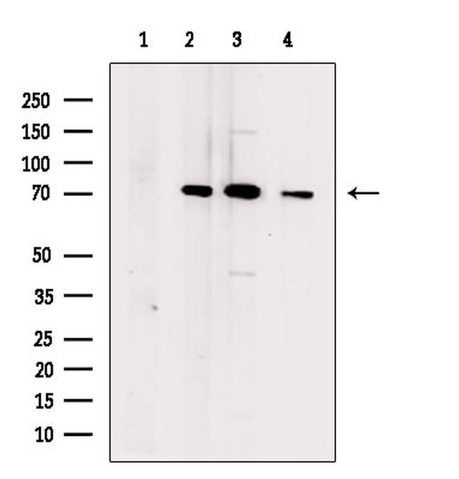 DCP2 Antibody in Western Blot (WB)