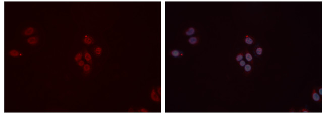 DDB1 Antibody in Immunocytochemistry (ICC/IF)