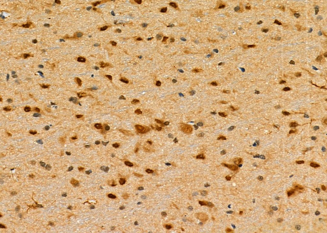 DDB1 Antibody in Immunohistochemistry (Paraffin) (IHC (P))