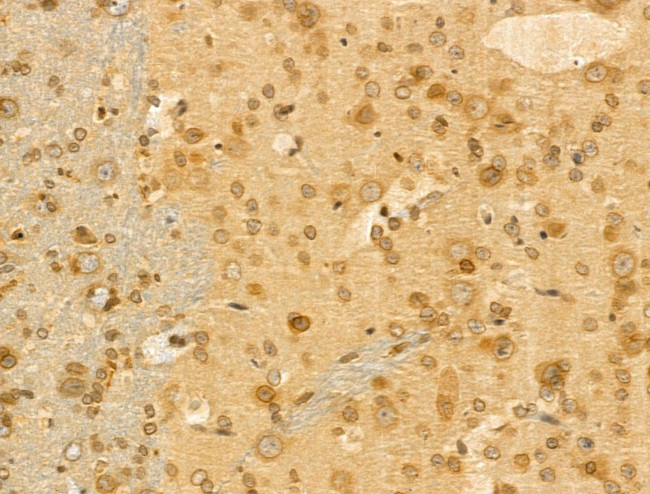 MCK10 Antibody in Immunohistochemistry (Paraffin) (IHC (P))