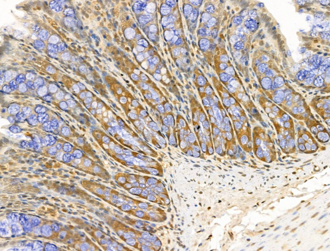 MCK10 Antibody in Immunohistochemistry (Paraffin) (IHC (P))