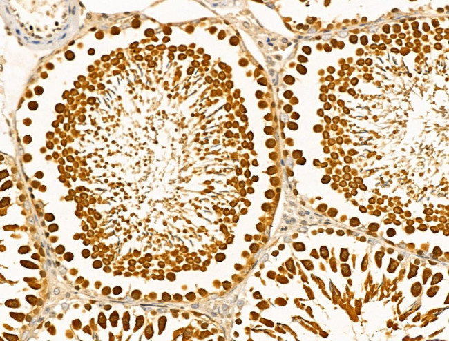 MCK10 Antibody in Immunohistochemistry (Paraffin) (IHC (P))