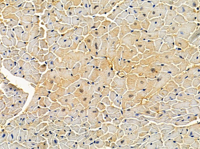 Dectin 1 Antibody in Immunohistochemistry (Paraffin) (IHC (P))