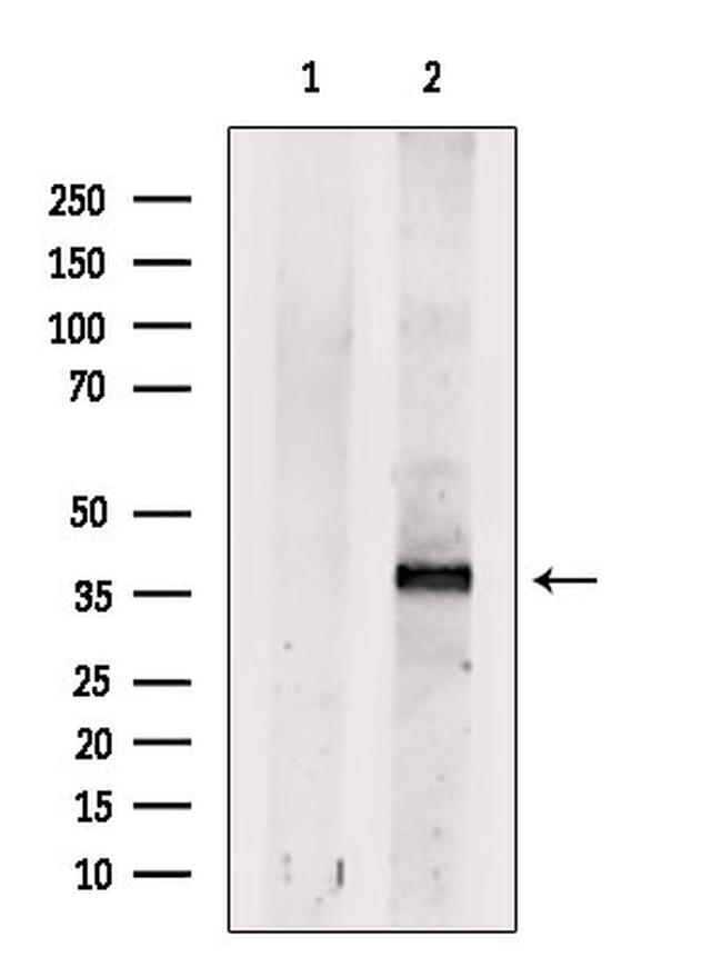 Dectin 1 Antibody in Western Blot (WB)