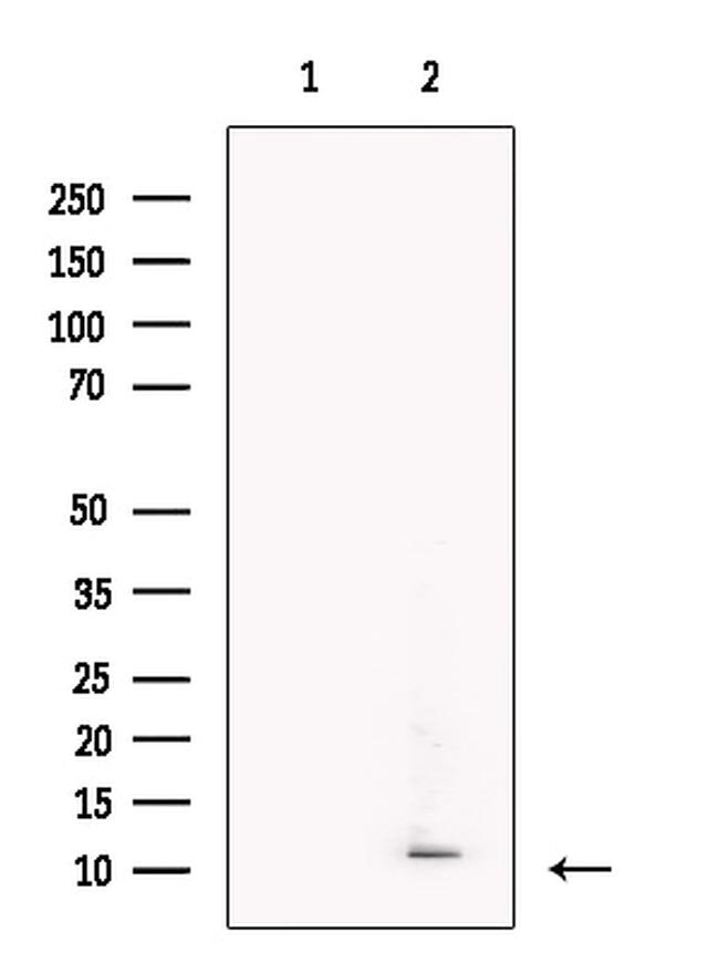 DCD Antibody in Western Blot (WB)