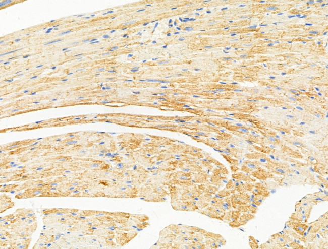 Desmin Antibody in Immunohistochemistry (Paraffin) (IHC (P))