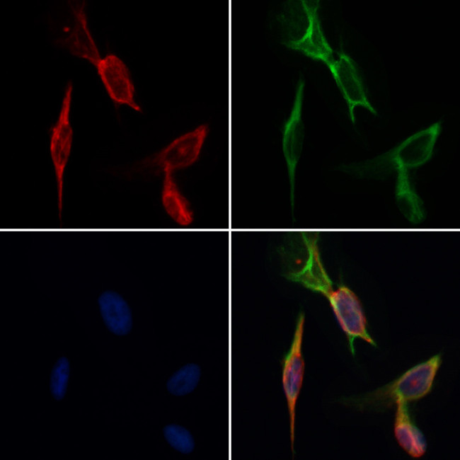 Desmin Antibody in Immunocytochemistry (ICC/IF)