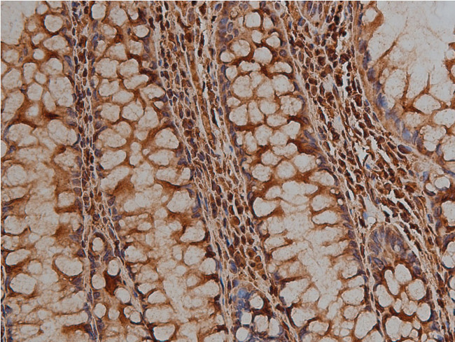 Desmin Antibody in Immunohistochemistry (Paraffin) (IHC (P))