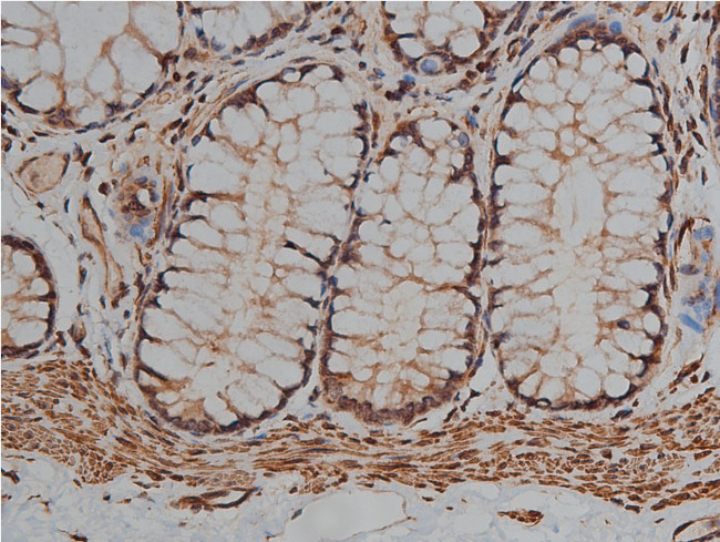 Desmin Antibody in Immunohistochemistry (Paraffin) (IHC (P))