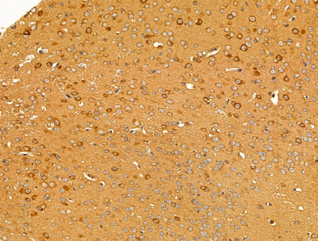 Desmin Antibody in Immunohistochemistry (Paraffin) (IHC (P))