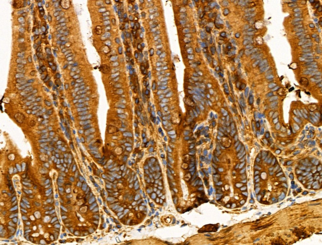 Desmin Antibody in Immunohistochemistry (Paraffin) (IHC (P))