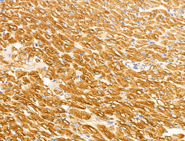 Desmin Antibody in Immunohistochemistry (Paraffin) (IHC (P))