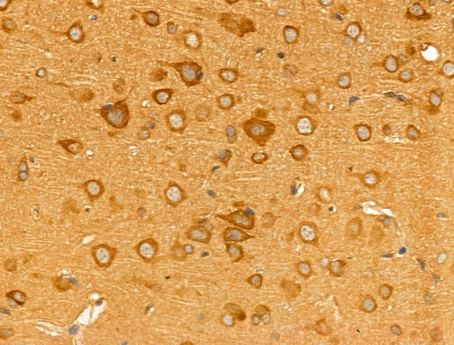 Desmin Antibody in Immunohistochemistry (Paraffin) (IHC (P))