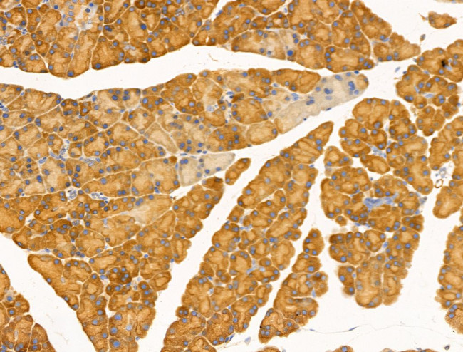 Desmin Antibody in Immunohistochemistry (Paraffin) (IHC (P))