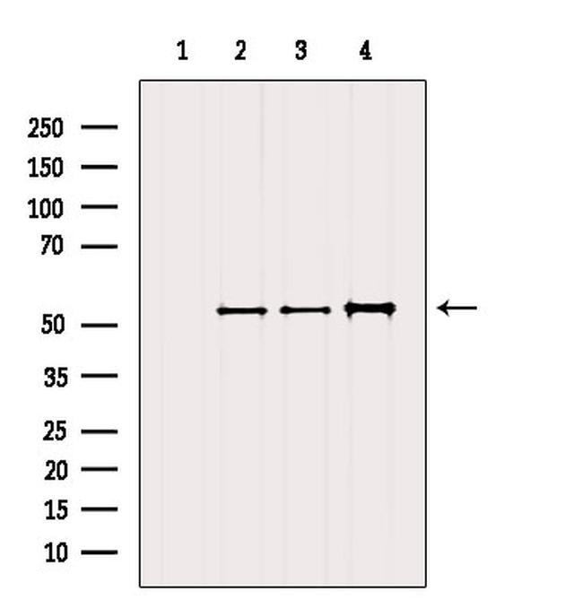 Desmin Antibody in Western Blot (WB)