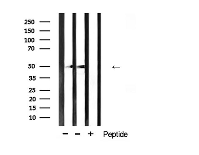 Desmin Antibody in Western Blot (WB)