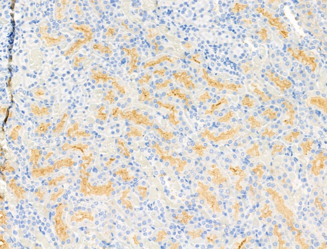 DGAT1 Antibody in Immunohistochemistry (Paraffin) (IHC (P))