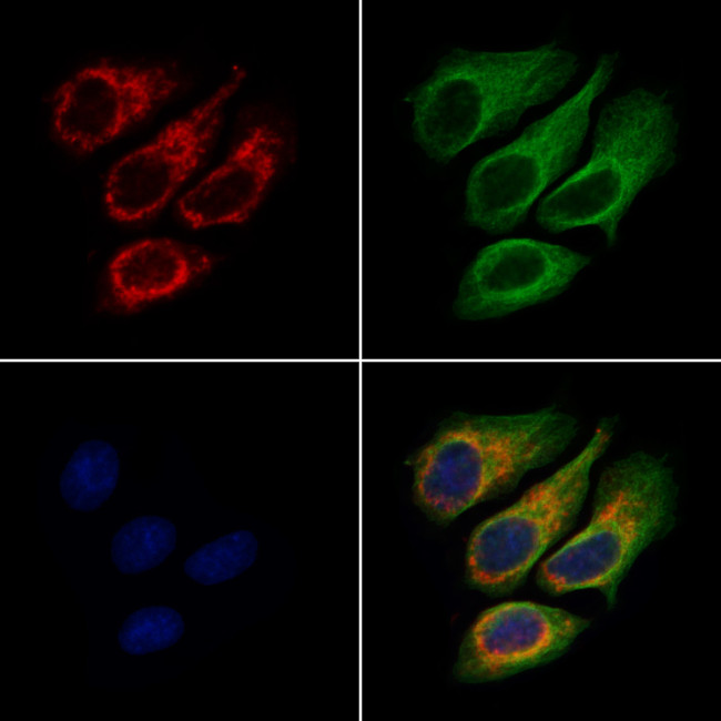 DHCR7 Antibody in Immunocytochemistry (ICC/IF)