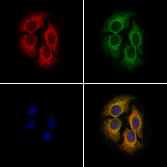 DHRS4 Antibody in Immunocytochemistry (ICC/IF)