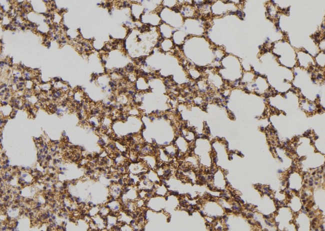 DHRS4 Antibody in Immunohistochemistry (Paraffin) (IHC (P))