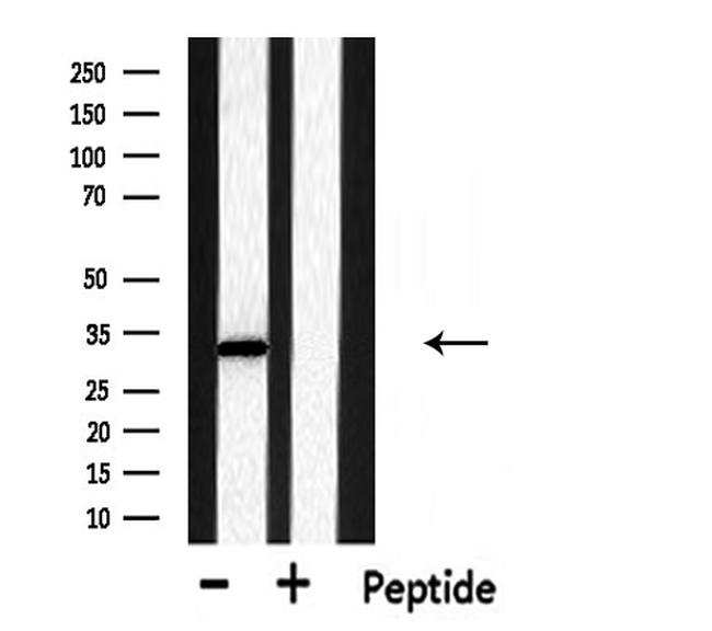 DHRS4 Antibody in Western Blot (WB)