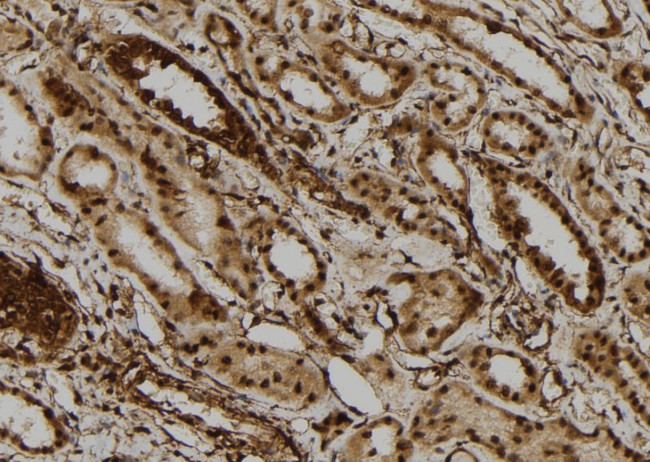 DHX9 Antibody in Immunohistochemistry (Paraffin) (IHC (P))