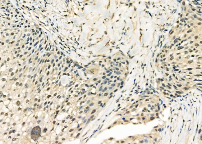 DHX9 Antibody in Immunohistochemistry (Paraffin) (IHC (P))