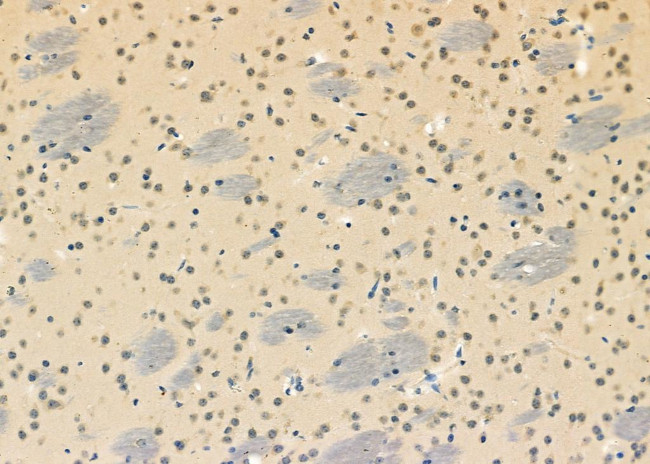 DHX9 Antibody in Immunohistochemistry (Paraffin) (IHC (P))