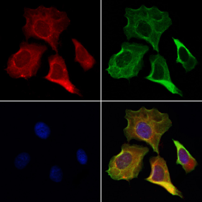 DIAPH3 Antibody in Immunocytochemistry (ICC/IF)