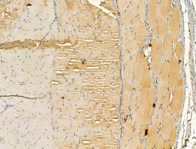 DIAPH3 Antibody in Immunohistochemistry (Paraffin) (IHC (P))