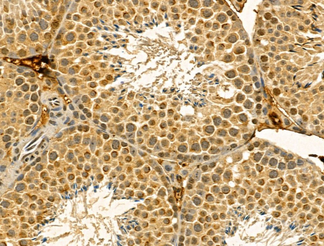 DIAPH3 Antibody in Immunohistochemistry (Paraffin) (IHC (P))