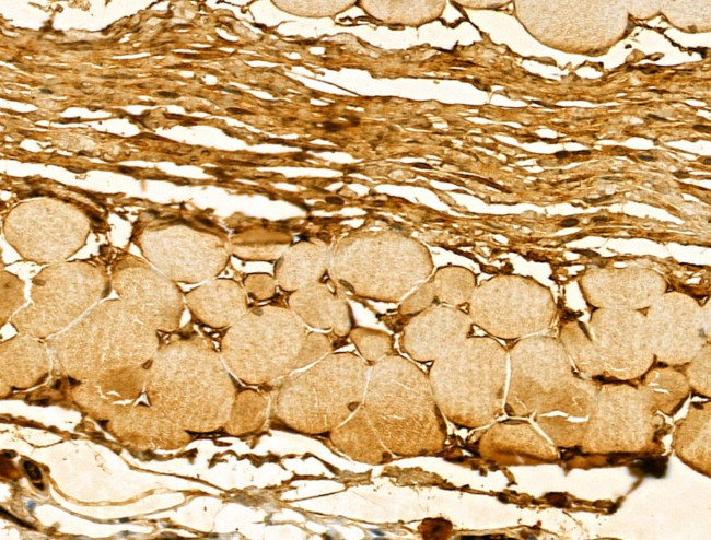 DIAPH3 Antibody in Immunohistochemistry (Paraffin) (IHC (P))