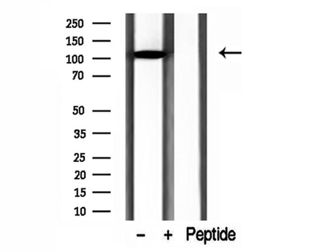 DIAPH3 Antibody in Western Blot (WB)