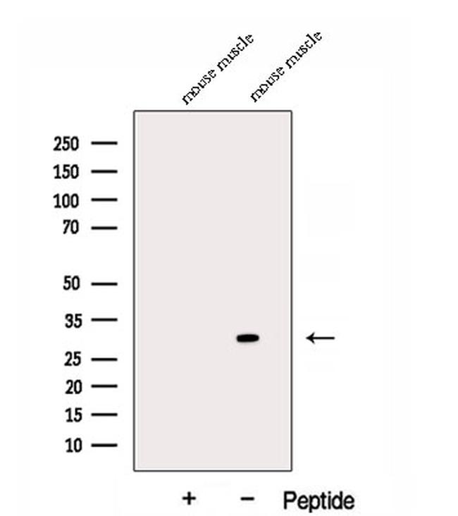 DKK2 Antibody in Western Blot (WB)